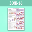 Плакат «Что такое лейкемия?» (ЗОЖ-16, ламинированная бумага, A2, 1 лист)